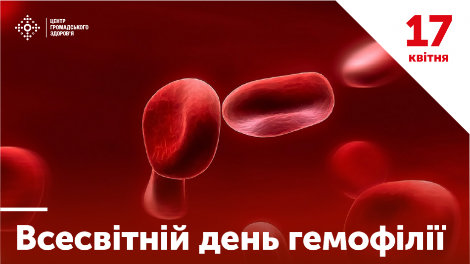 Гемофілія(До Всесвітнього дня боротьби з гемофілією) Гемофілія(До Всесвітнього дня боротьби з гемофілією)